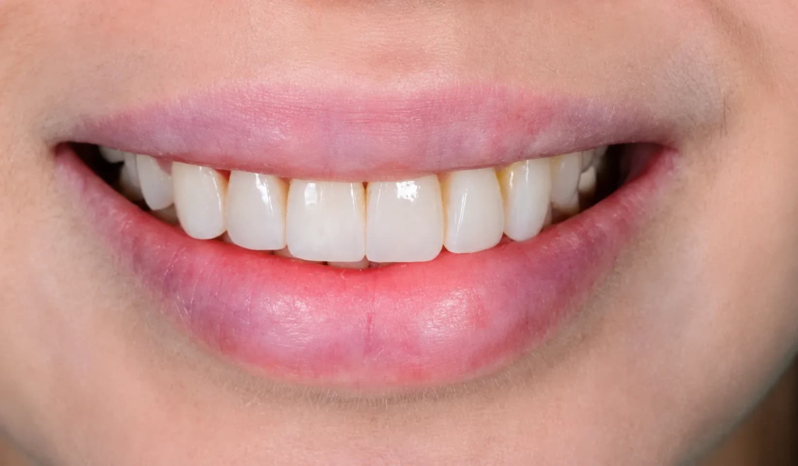 Aesthetic Dentistry